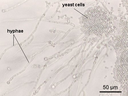 candida yeast infection microscope under albicans bacteria oral fungal skin decay tooth cause thrush infections pregnancy drwile