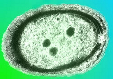 This is an electron microscope image of a bacterium from genus Prochlorococcus.  The colors were added artificially. (click for credit)