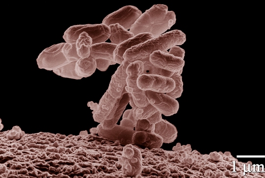 A cluster of the bacteria discussed in the article