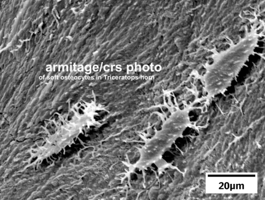 Electron microscope image of three soft bone cells from a dinosaur fossil 