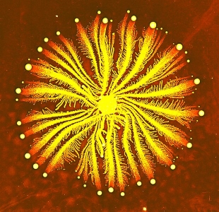 A colony of bacteria similar to the one analyzed in the study being discussed.  (click for credit)