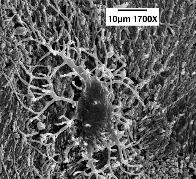 dinosaur soft tissue discovery